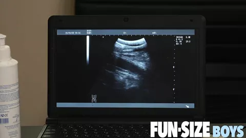 Sexo anal en ultrasonido