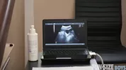 Check-up d'un jeune passif
