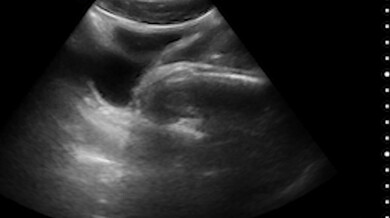 A infame máquina de ultrassom - Legrand Wolf, Lane Colten e Dylan Tides