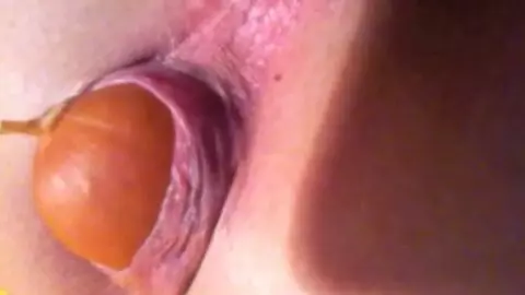 Wurst 2 – deutsche Wurst im Arsch