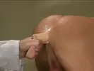 prostate exam in spanish