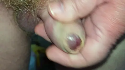 Orgasme et éjaculation