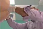 Fisting beim Doktor